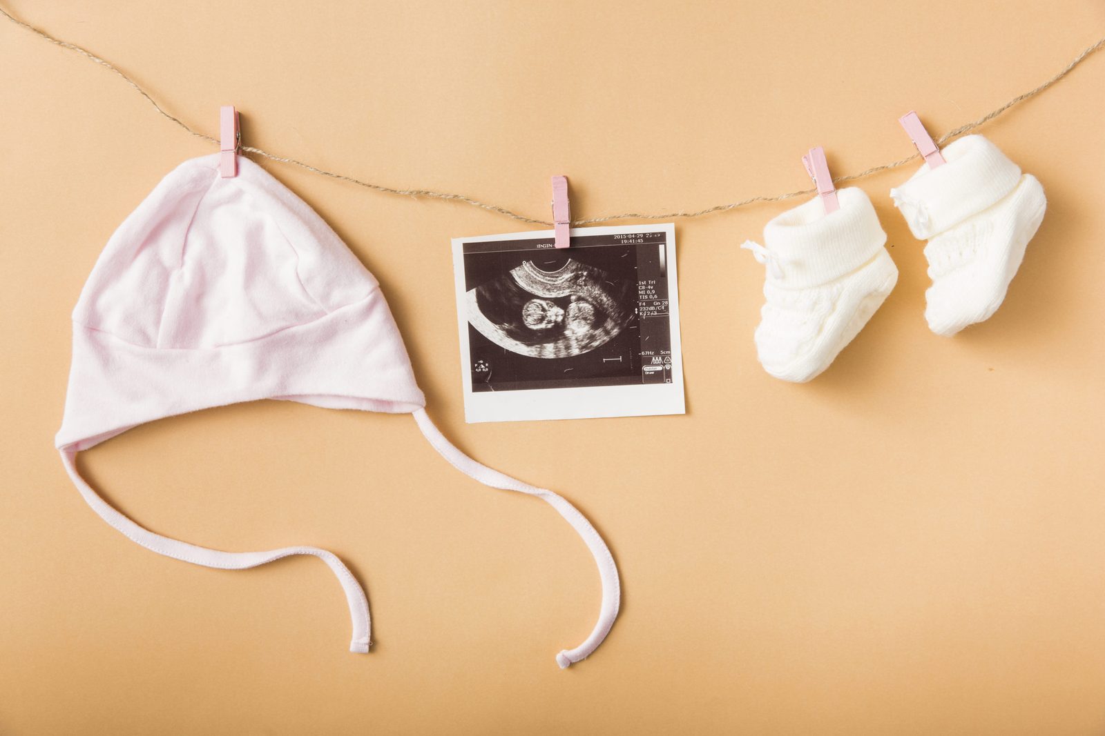 Bonnet de bébé, échographie et chaussons suspendus à une corde à linge